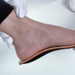 Custom Insole Manufacturing