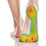 Foot Pressure Measurement for Diabetic Patients